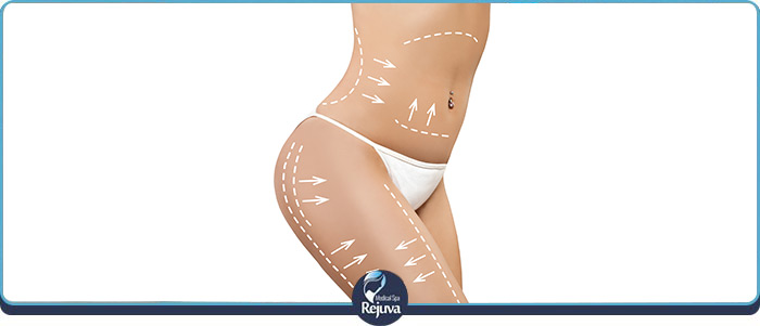 Benefits of Body Sculpting Near Me in Chesapeake VA Benefits of Body Sculpting Near Me in Chesapeake VA