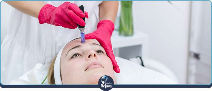 Microneedling Specialist Near Me in Chesapeake, VA Microneedling Specialist Near Me in Chesapeake, VA