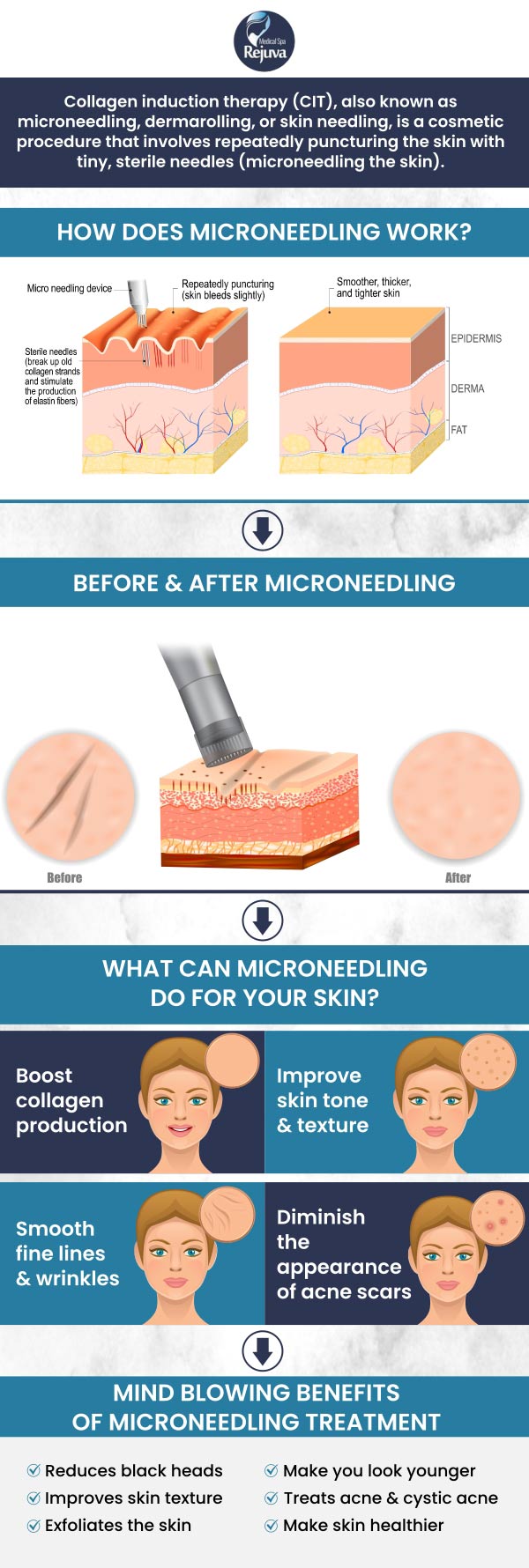 Benefits Of Microneedling Treatment Near Me In Chesapeake VA Benefits Of Microneedling Treatment Near Me In Chesapeake VA