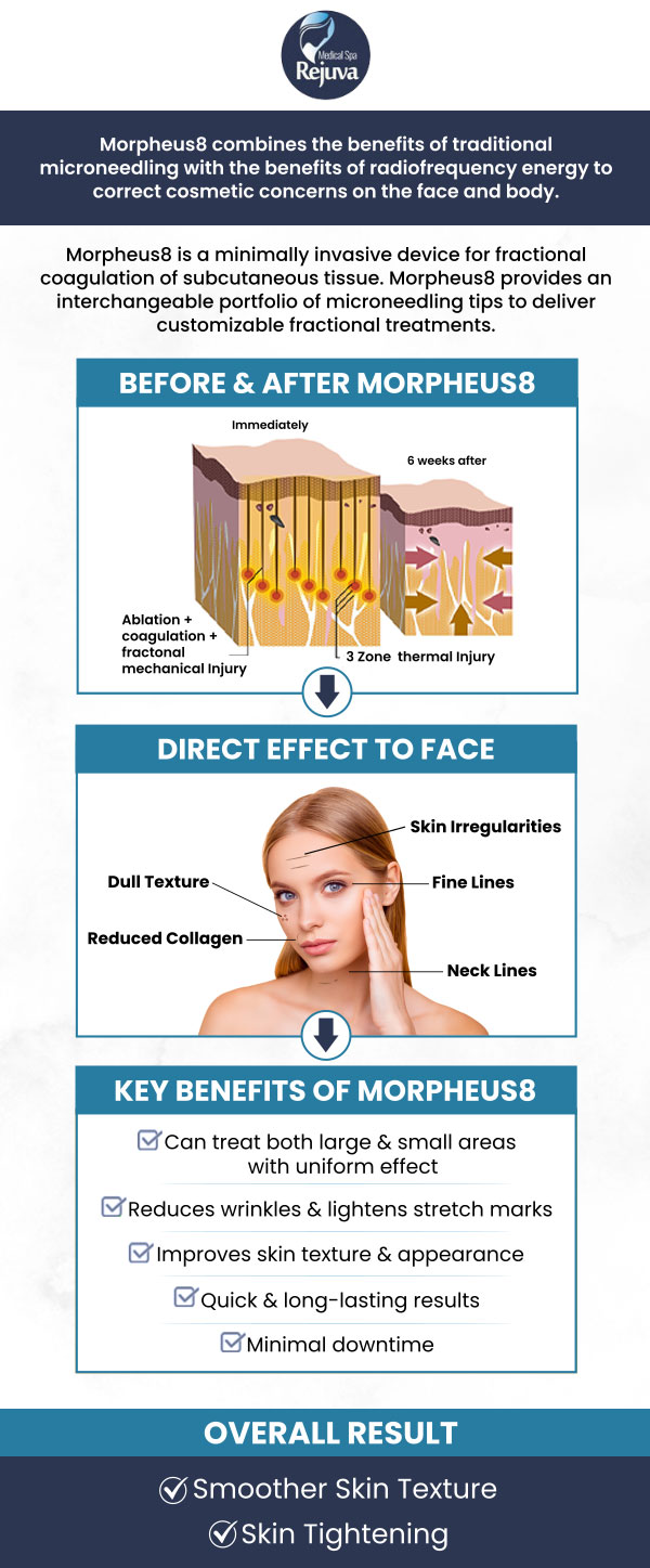 Common questions asked by clients: What is Morpheus8 and how does it work? Is Morpheus8 safe for all skin types? How many treatments of Morpheus8 will I need? What areas can be treated with Morpheus8? At Rejuva Medical Spa, Kara Hemsey Stumm offers Morpheus8, a cutting-edge treatment that combines microneedling with radiofrequency energy to target deeper layers of the skin. This minimally invasive procedure stimulates collagen production, helping to tighten skin, reduce wrinkles, and improve texture. It is suitable for various areas of the face and body, delivering noticeable results with minimal downtime. For more information, contact us or schedule an appointment online. We are located at 3925 Portsmouth Blvd, Chesapeake, VA 23321. Common questions asked by clients: What is Morpheus8 and how does it work? Is Morpheus8 safe for all skin types? How many treatments of Morpheus8 will I need? What areas can be treated with Morpheus8? At Rejuva Medical Spa, Kara Hemsey Stumm offers Morpheus8, a cutting-edge treatment that combines microneedling with radiofrequency energy to target deeper layers of the skin. This minimally invasive procedure stimulates collagen production, helping to tighten skin, reduce wrinkles, and improve texture. It is suitable for various areas of the face and body, delivering noticeable results with minimal downtime. For more information, contact us or schedule an appointment online. We are located at 3925 Portsmouth Blvd, Chesapeake, VA 23321.