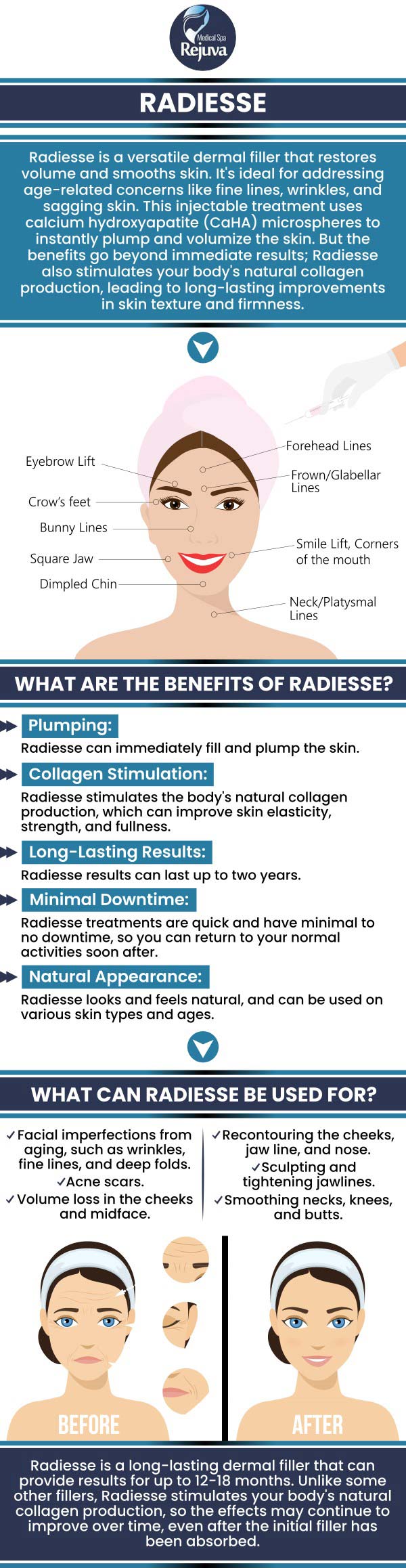 Common questions asked by clients: What is Radiesse? How does Radiesse work? What areas can Radiesse treat? How long do Radiesse results last? At Rejuva Medical Spa, Kara Hemsey Stumm and her dedicated team specialize in Radiesse treatments to restore facial volume and smooth wrinkles. Radiesse is an FDA-approved dermal filler, that provides natural-looking and long-lasting results. Kara's expertise ensures personalized care, addressing individual aesthetic goals to enhance facial contours and rejuvenate the skin. For more information, contact us or schedule an appointment online. We are located at 3925 Portsmouth Blvd, Chesapeake, VA 23321. Common questions asked by clients: What is Radiesse? How does Radiesse work? What areas can Radiesse treat? How long do Radiesse results last? At Rejuva Medical Spa, Kara Hemsey Stumm and her dedicated team specialize in Radiesse treatments to restore facial volume and smooth wrinkles. Radiesse is an FDA-approved dermal filler, that provides natural-looking and long-lasting results. Kara's expertise ensures personalized care, addressing individual aesthetic goals to enhance facial contours and rejuvenate the skin. For more information, contact us or schedule an appointment online. We are located at 3925 Portsmouth Blvd, Chesapeake, VA 23321.Common questions asked by clients: What is Radiesse? How does Radiesse work? What areas can Radiesse treat? How long do Radiesse results last? At Rejuva Medical Spa, Kara Hemsey Stumm and her dedicated team specialize in Radiesse treatments to restore facial volume and smooth wrinkles. Radiesse is an FDA-approved dermal filler, that provides natural-looking and long-lasting results. Kara's expertise ensures personalized care, addressing individual aesthetic goals to enhance facial contours and rejuvenate the skin. For more information, contact us or schedule an appointment online. We are located at 3925 Portsmouth Blvd, Chesapeake, VA 23321.