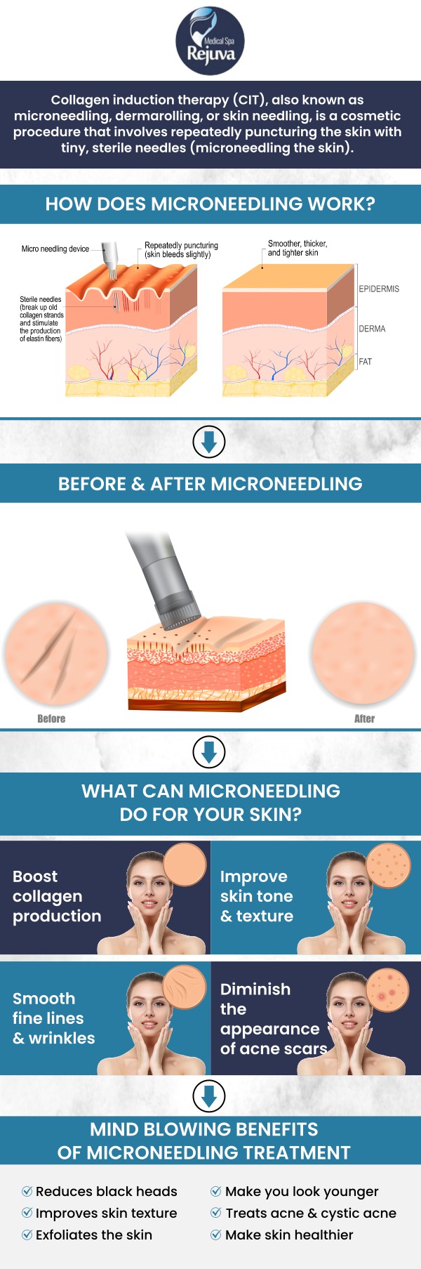 At Rejuva Medical Spa, Kara Hemsey Stumm specializes in skin resurfacing and rejuvenation. By using advanced microneedling techniques, she can create a personalized treatment plan that is tailored to your specific skin concerns.For more information, contact us or book an appointment online. We are conveniently located at 3925 Portsmouth Blvd, Chesapeake, VA 23321.