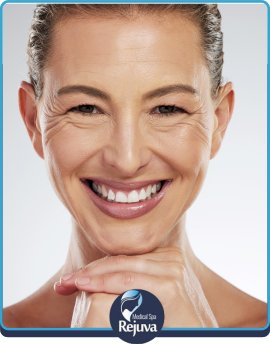 Crow’s Feet at Rejuva Medical Spa in Chesapeake, VA Crow’s Feet at Rejuva Medical Spa in Chesapeake, VA