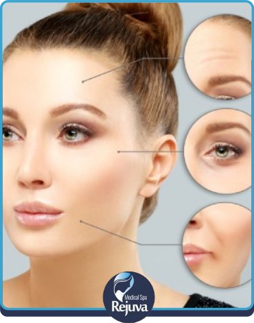 DAO Botox at Rejuva Medical Spa in Chesapeake, VA DAO Botox at Rejuva Medical Spa in Chesapeake, VA