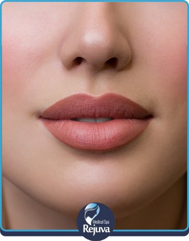 Lip Flip at Rejuva Medical Spa in Chesapeake, VA Lip Flip at Rejuva Medical Spa in Chesapeake, VA